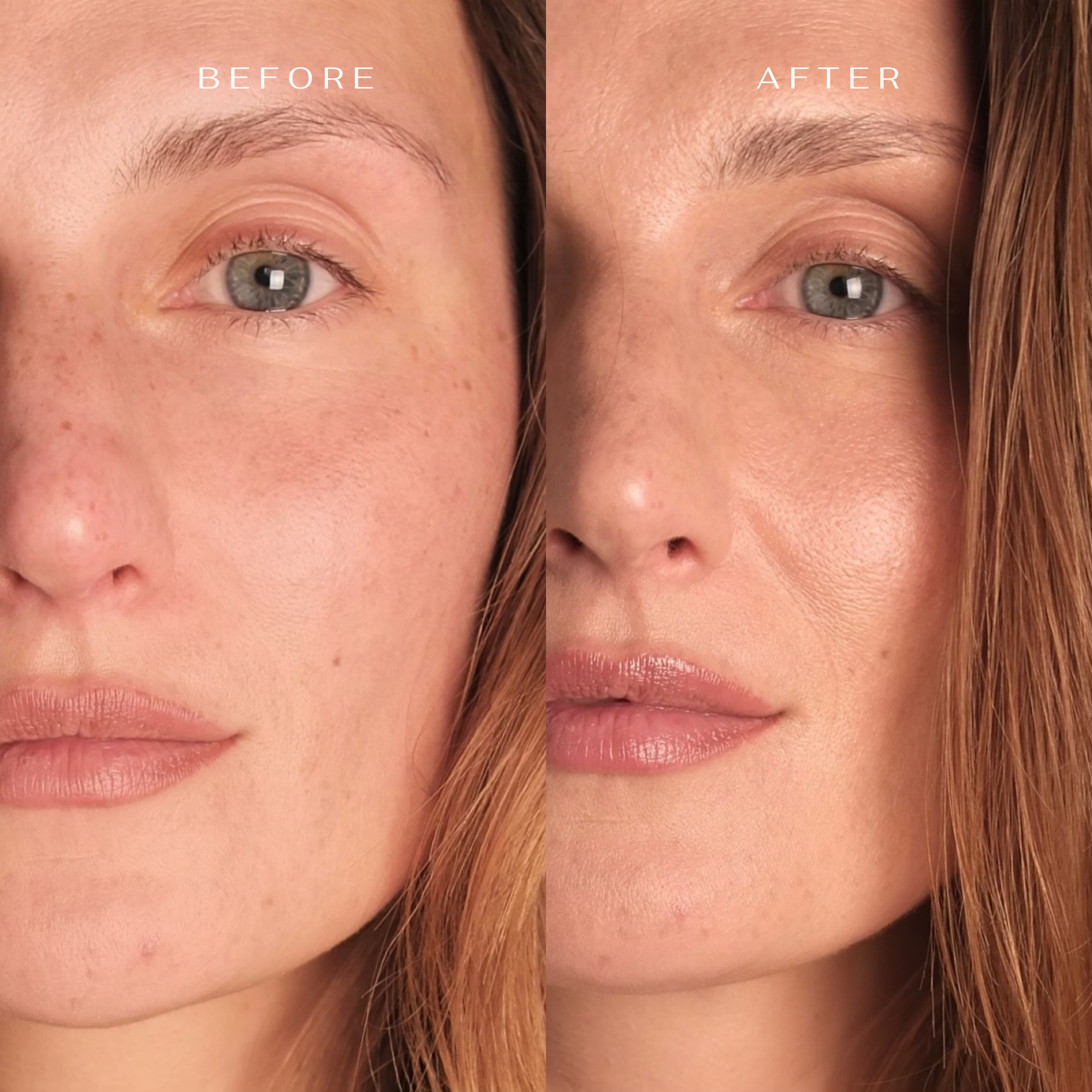 VIP Face and neck skin care kit