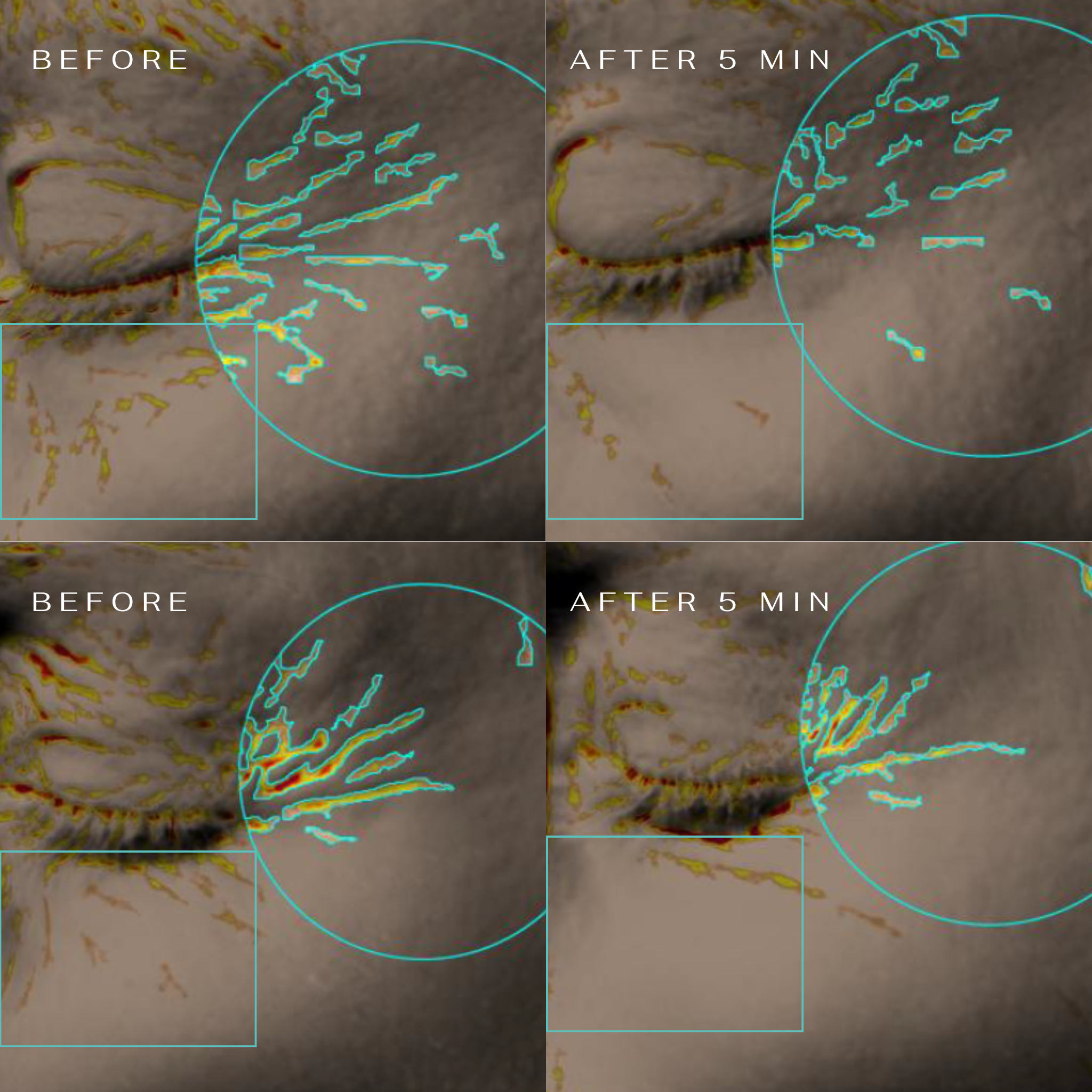 5 Minute Revolution paakių padeliai