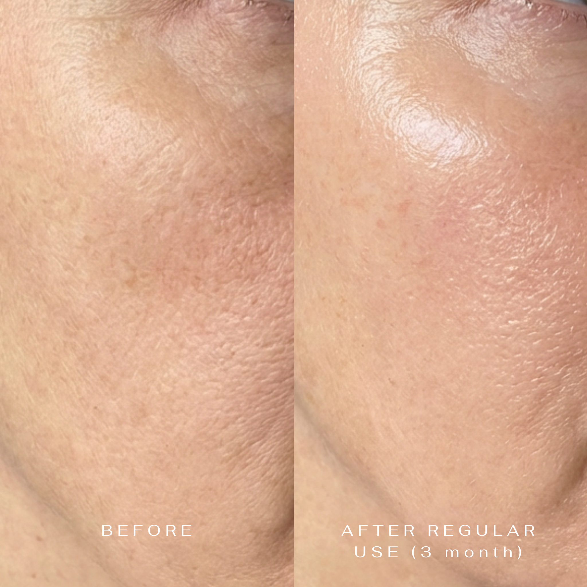 Food Supplement Revolution in anti-aging solutions