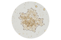 BioSignal™ Lipid 10 MB